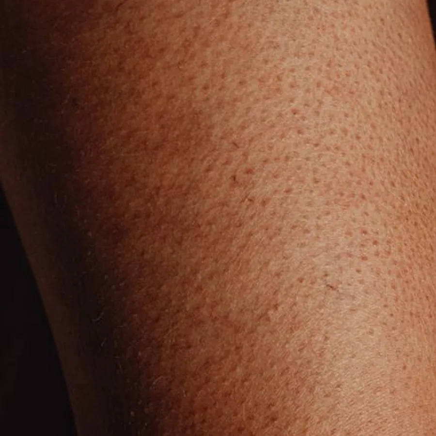 Keratin Bakımı